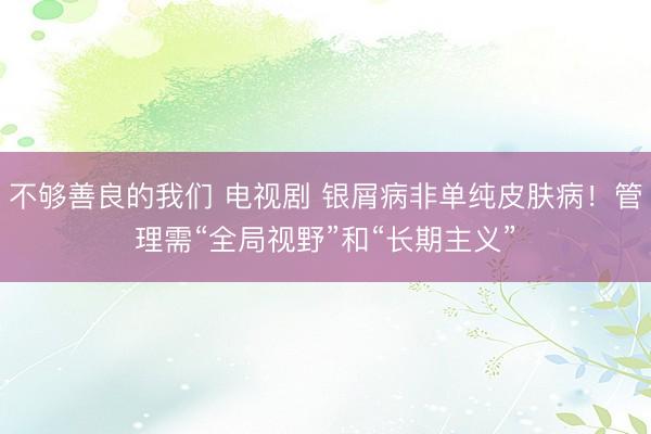 不够善良的我们 电视剧 银屑病非单纯皮肤病！管理需“全局视野”和“长期主义”